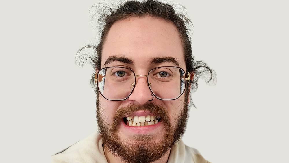 Invisalign (2)