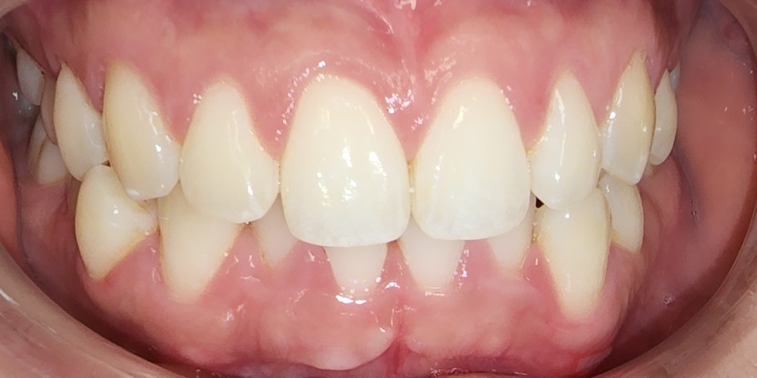 Case 2 after